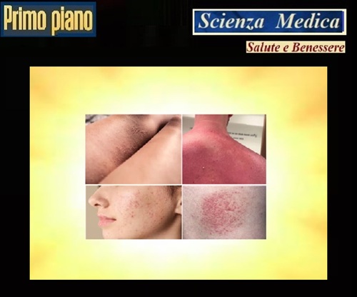 CREME-SOLARI-FAI-DA-TE-Il-Falso-Rimedio-che-Puo-Trasformare-il-Sole-in-un-Rischio